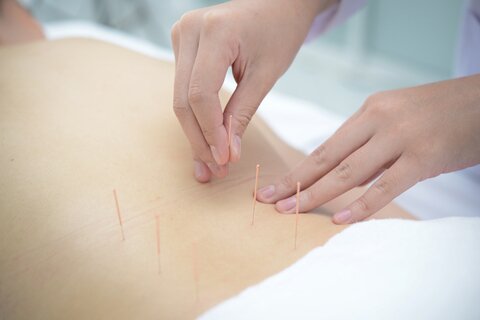 acupuncturist